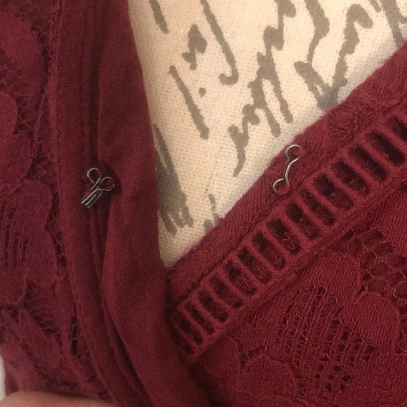 Hollister V-neck Lace Dress - Picture 7 of 10